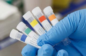 Five cryogenic vials are labeled with color coded labels that include patient name and specimen type.