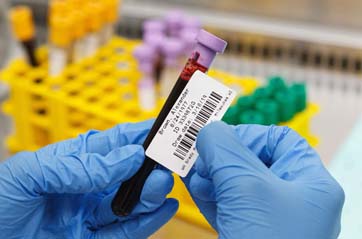 A blood tube is getting a barcode label with patient information applied.