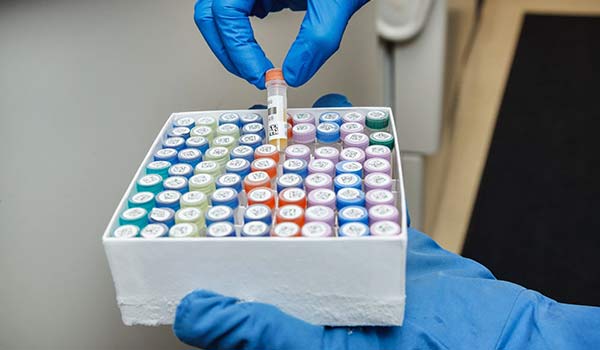 Cryogenic labels with barcodes and qr codes with color coded caps.