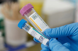 Two laboratory test tubes are labeled with a color coded label that includes a qr code.