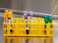 Blood samples are labeled with patient data.